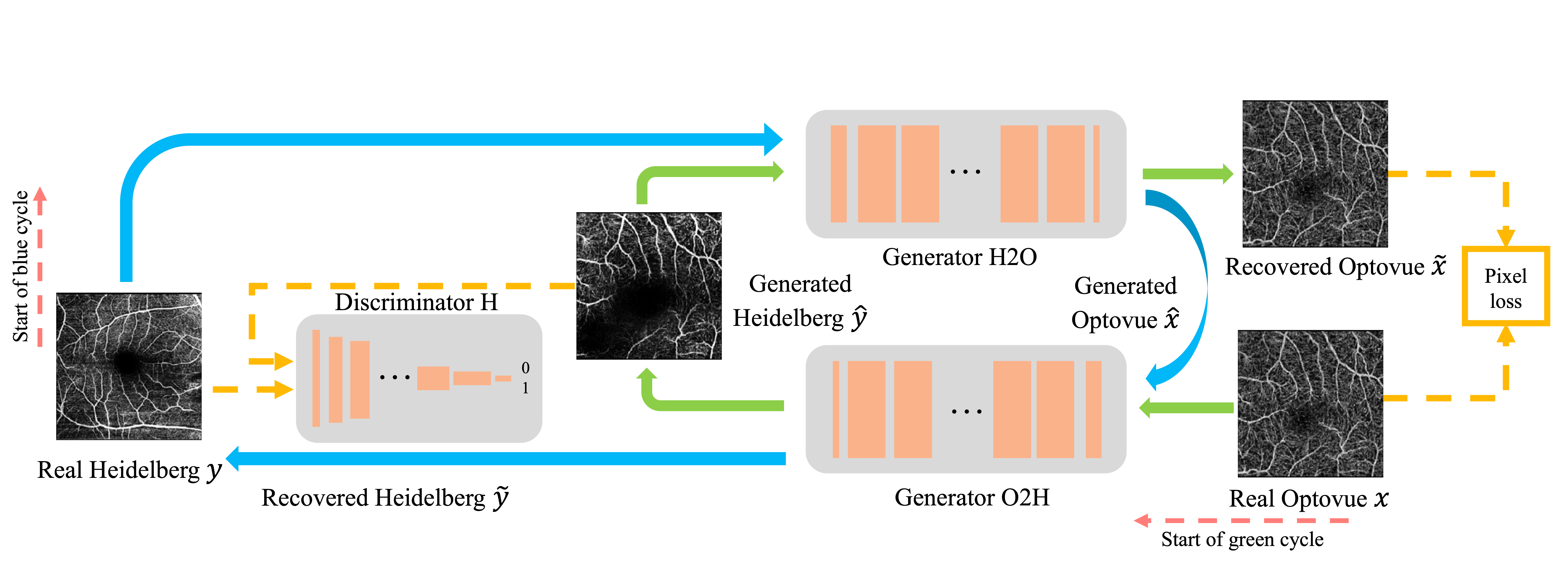 Illustration of our framework utilizing CycleGAN to transfer samples between Heidelberg and Optovue domains. For simplicity, only one channel of OCTA projection is displayed, and the identity loss is omitted. In the Green cycle, a real Optovue sample $x$ undergoes translation to the Heidelberg domain using the generator $G_{O2H}(\cdot)$, resulting in $\hat{y}$. Subsequently, $\hat{y}$ is translated back to the Optovue domain through another generator $G_{H2O}(\cdot)$, producing the recovered Optovue image $\tilde{x}$. By imposing an L1 loss between $x$ and $\tilde{x}$, we ensures faithful reconstruction, preserving both content and style in Optovue domain. Adversarial loss between $y$ and $ \hat{y}$ enforces the transferred image share same style as samples in Heidelberg domain.