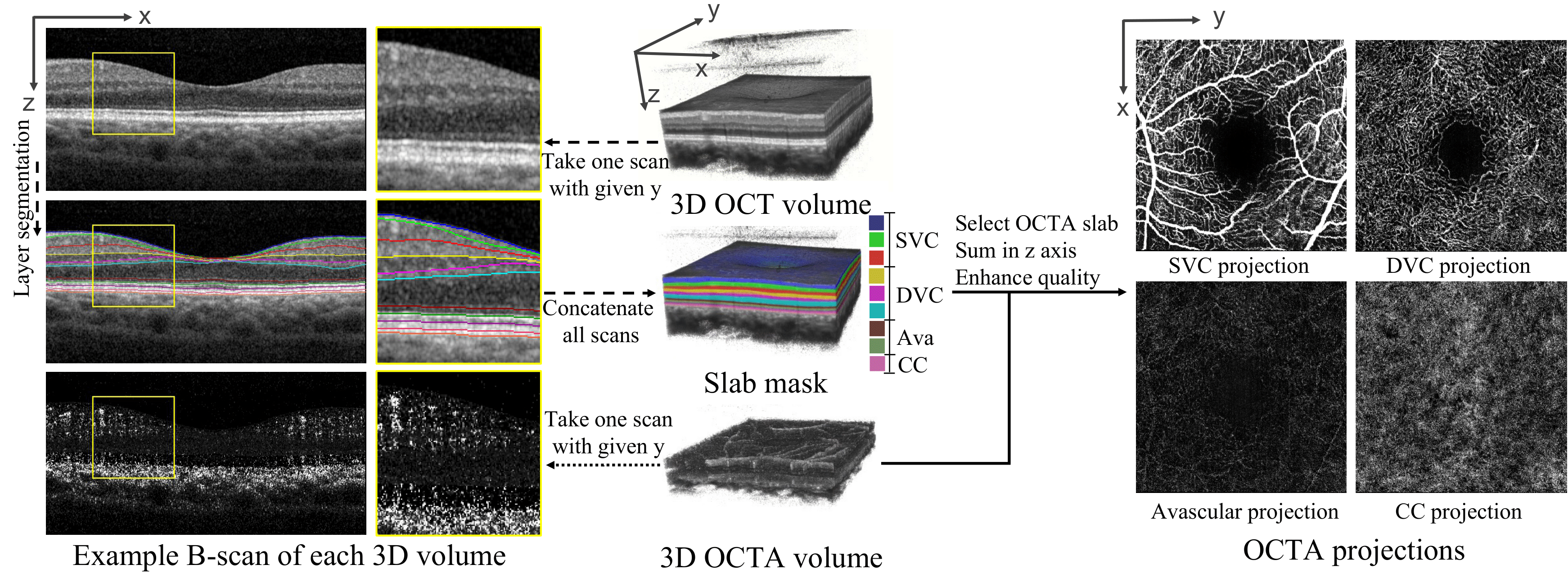 Interrelationships among OCT and OCTA raw volume, B-scans, and OCTA projection. OCT B-Scan layer segmentation influences OCTA projection generation.